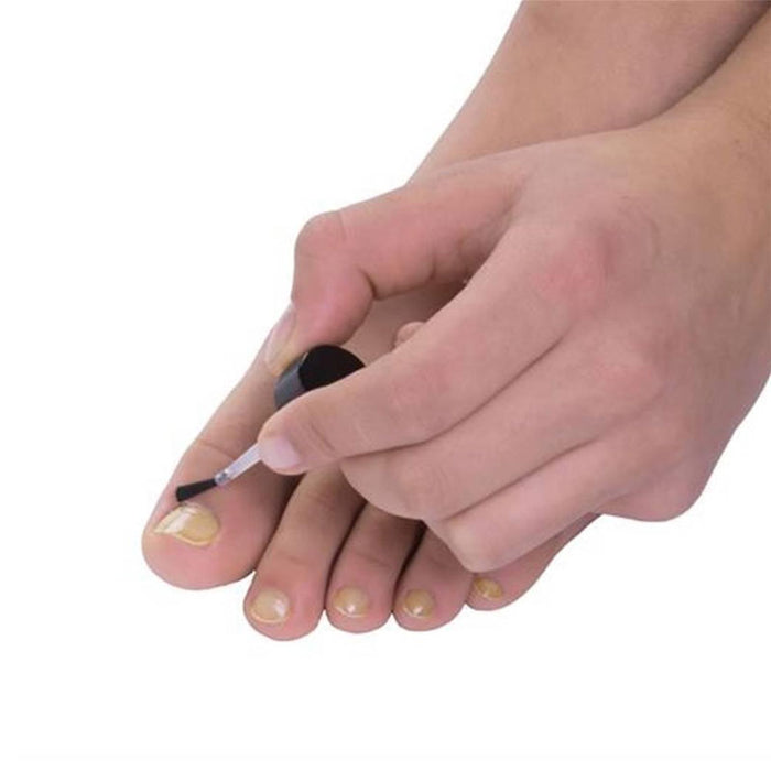 ANTIFUNGAL TREATMENT
